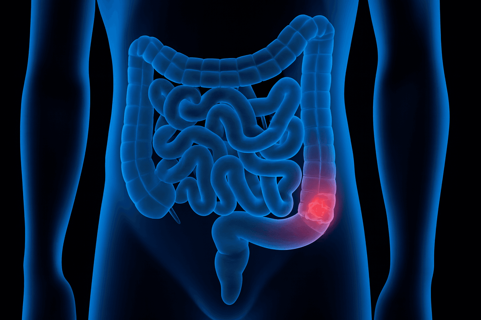 Colorectal Surgery