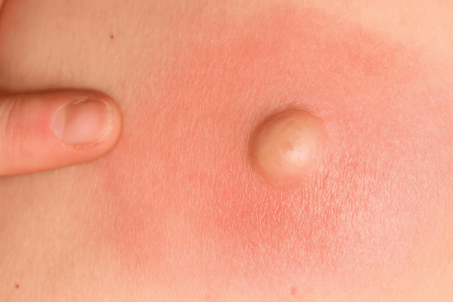 Lumps and Bumps
