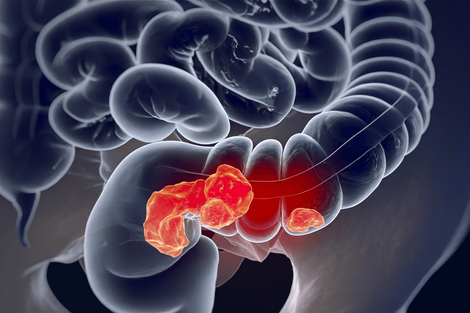 Advanced Ano-rectal Care